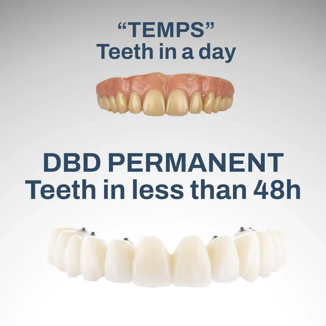 Teeth In A Day vs. 48-Hour Permanent Teeth