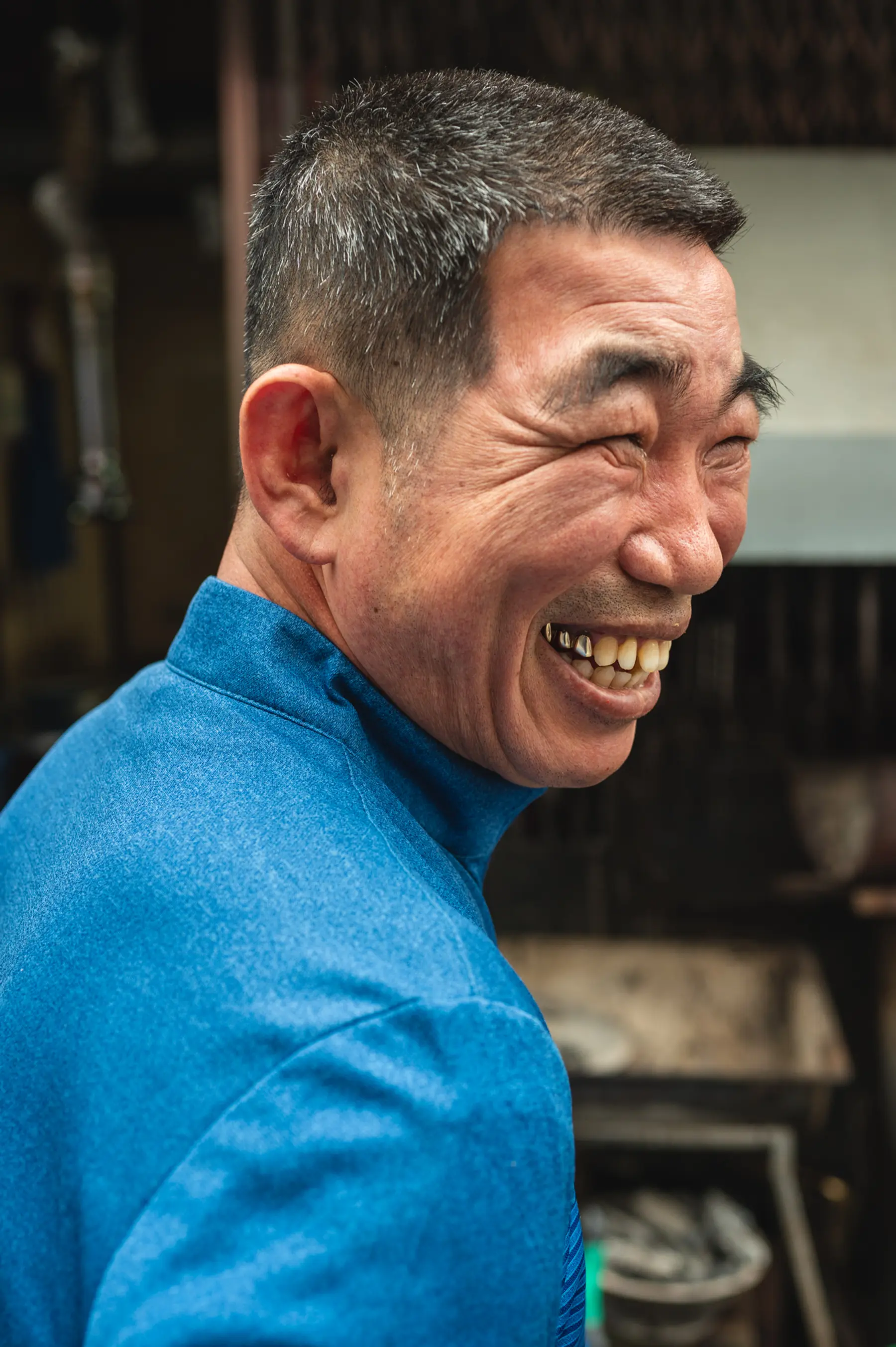Middle-aged Korean man smiles widely, revealing 3 gold teeth