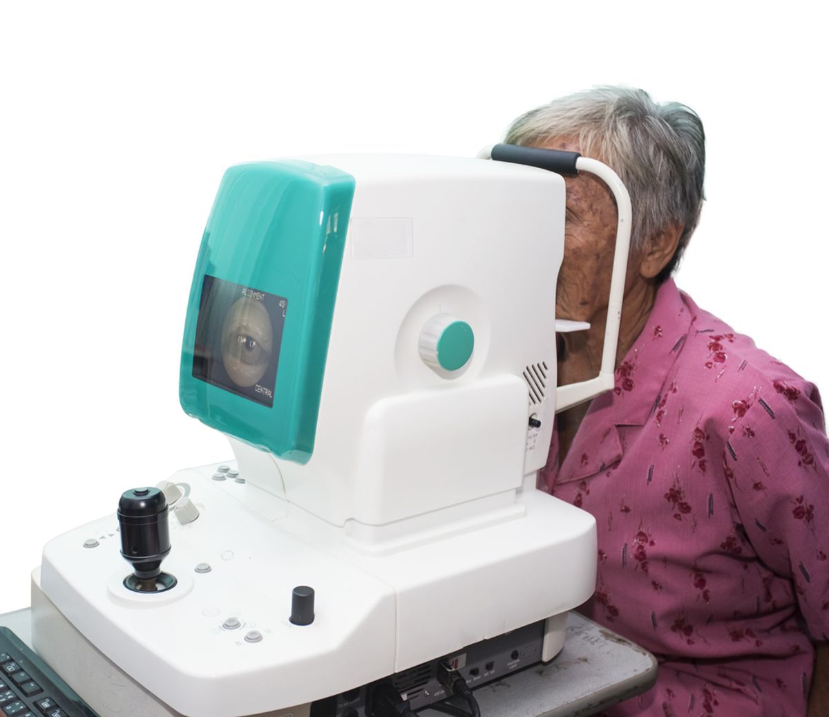 Patient's,Eyes,Being,Examined,By,Digital,Retina,Camera