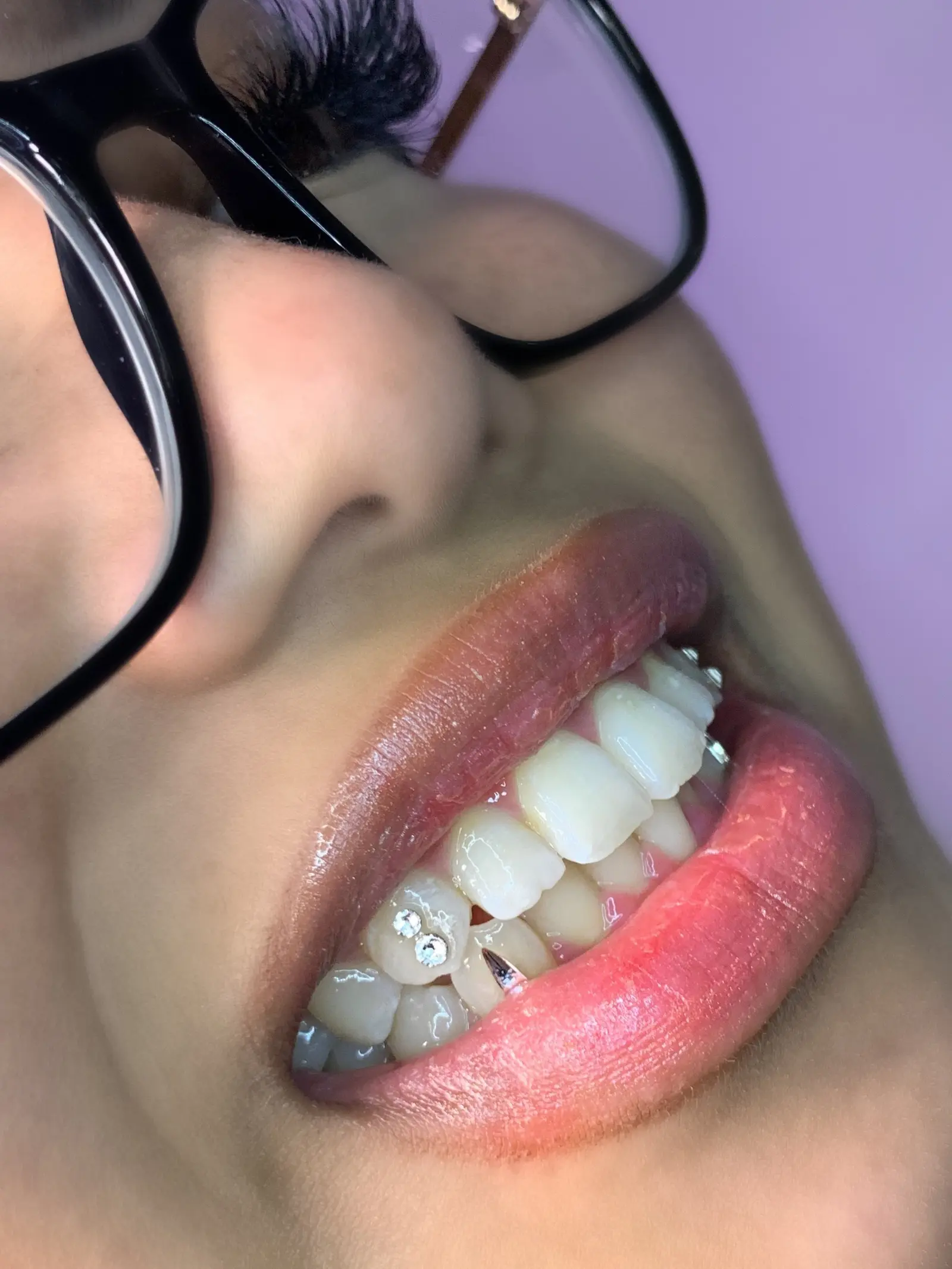 Nhi applying tooth gems