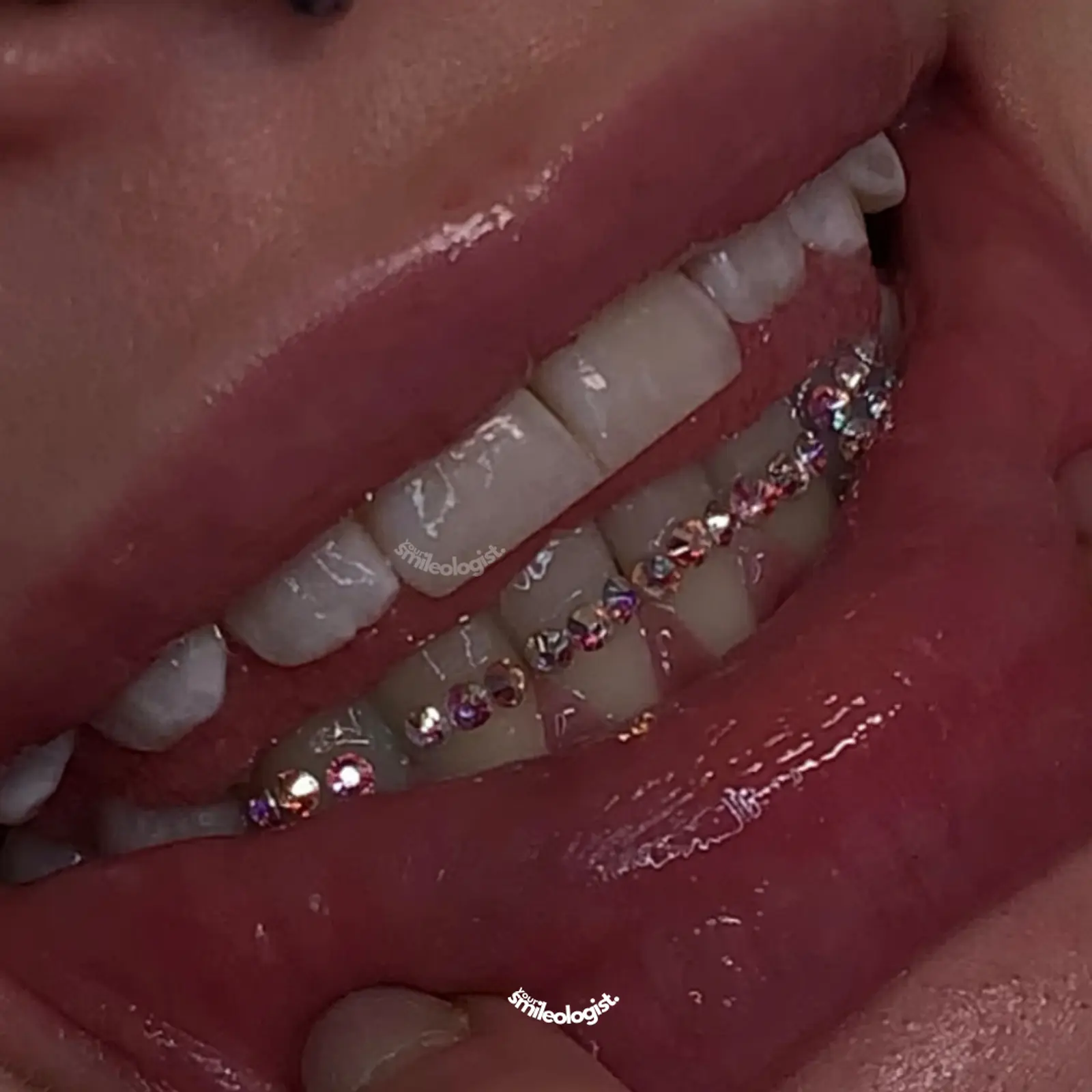 Tooth gem collection