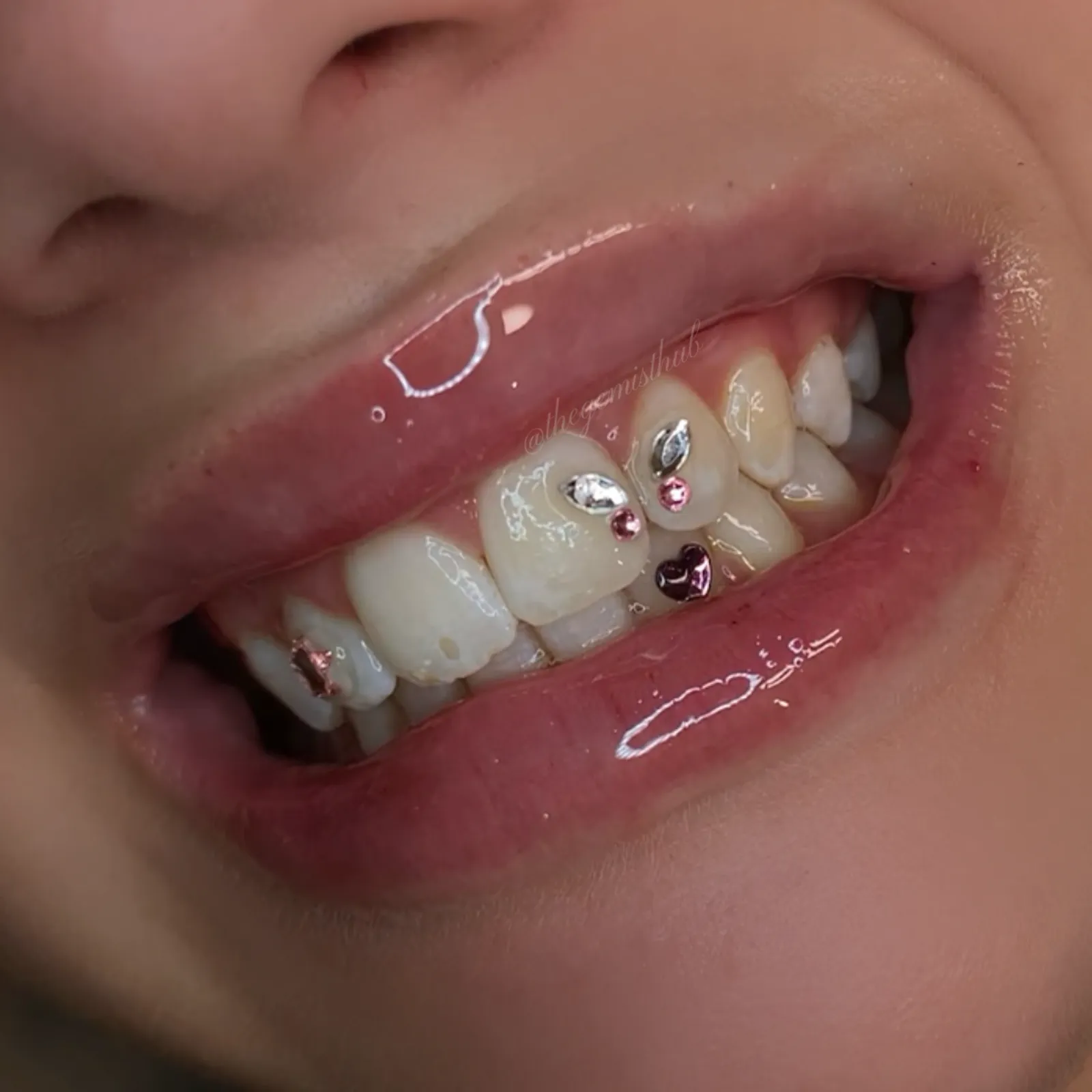 Nhi's credentials and education