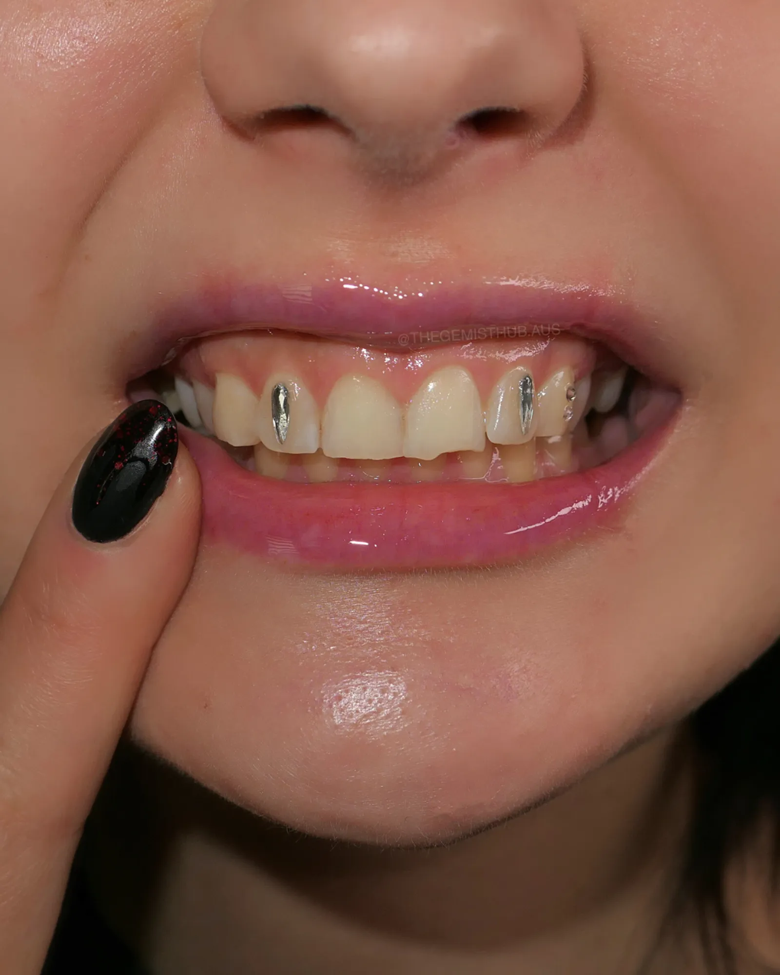 Tooth gem collection display