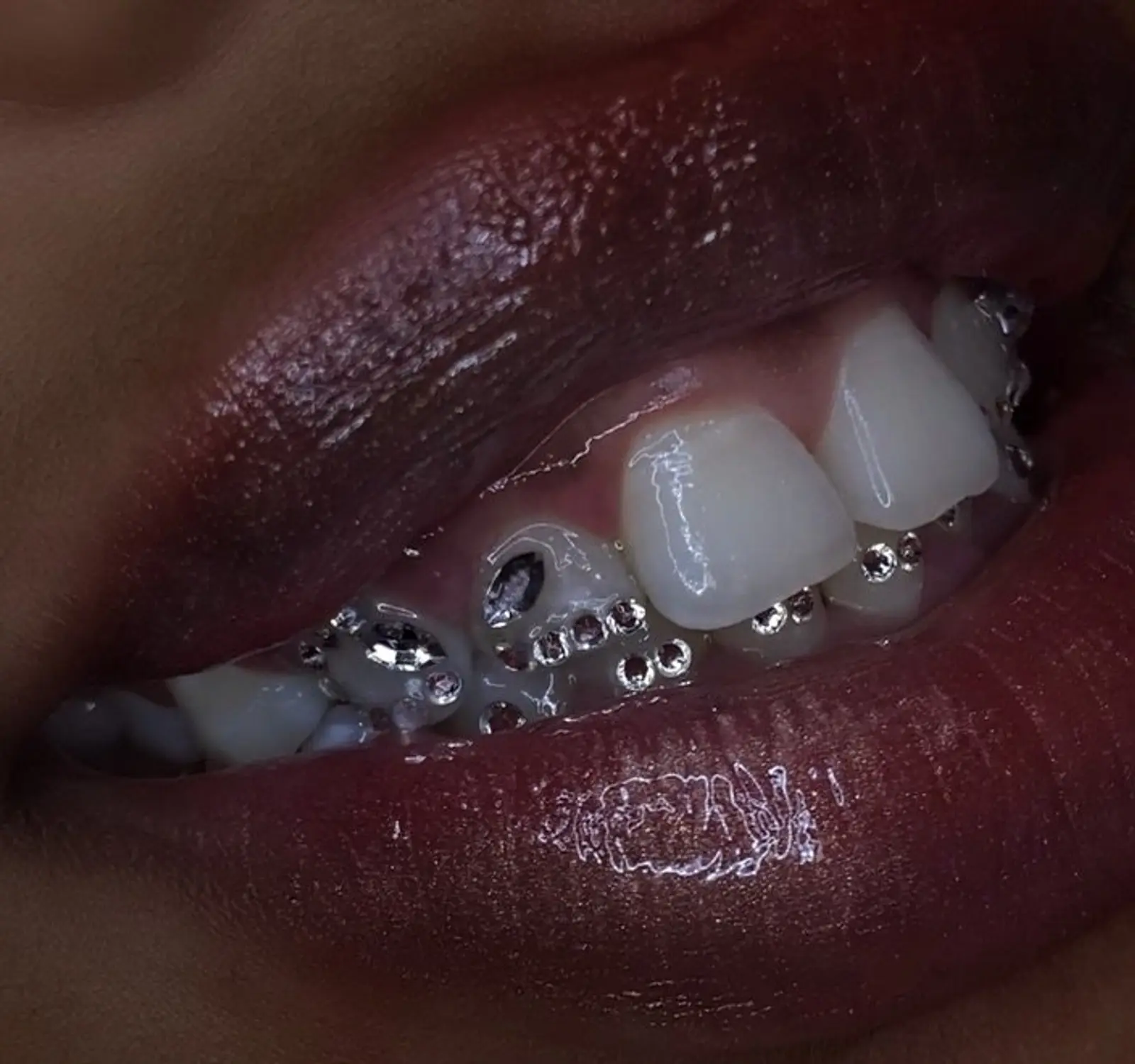 Swarovski tooth gem
