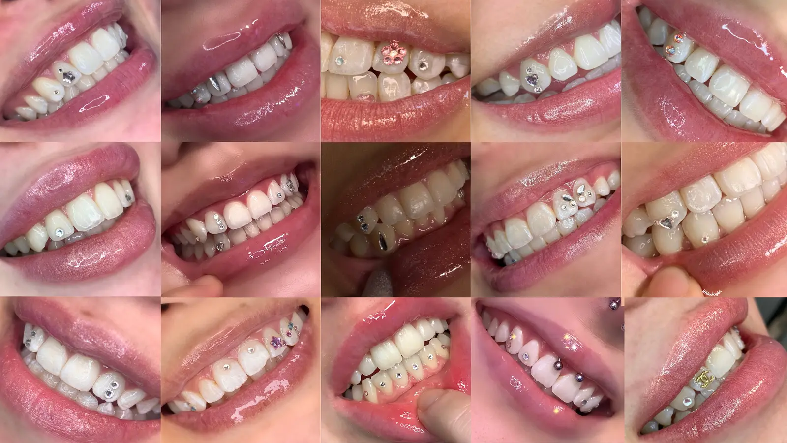 Tooth gems by The Gemist Hub