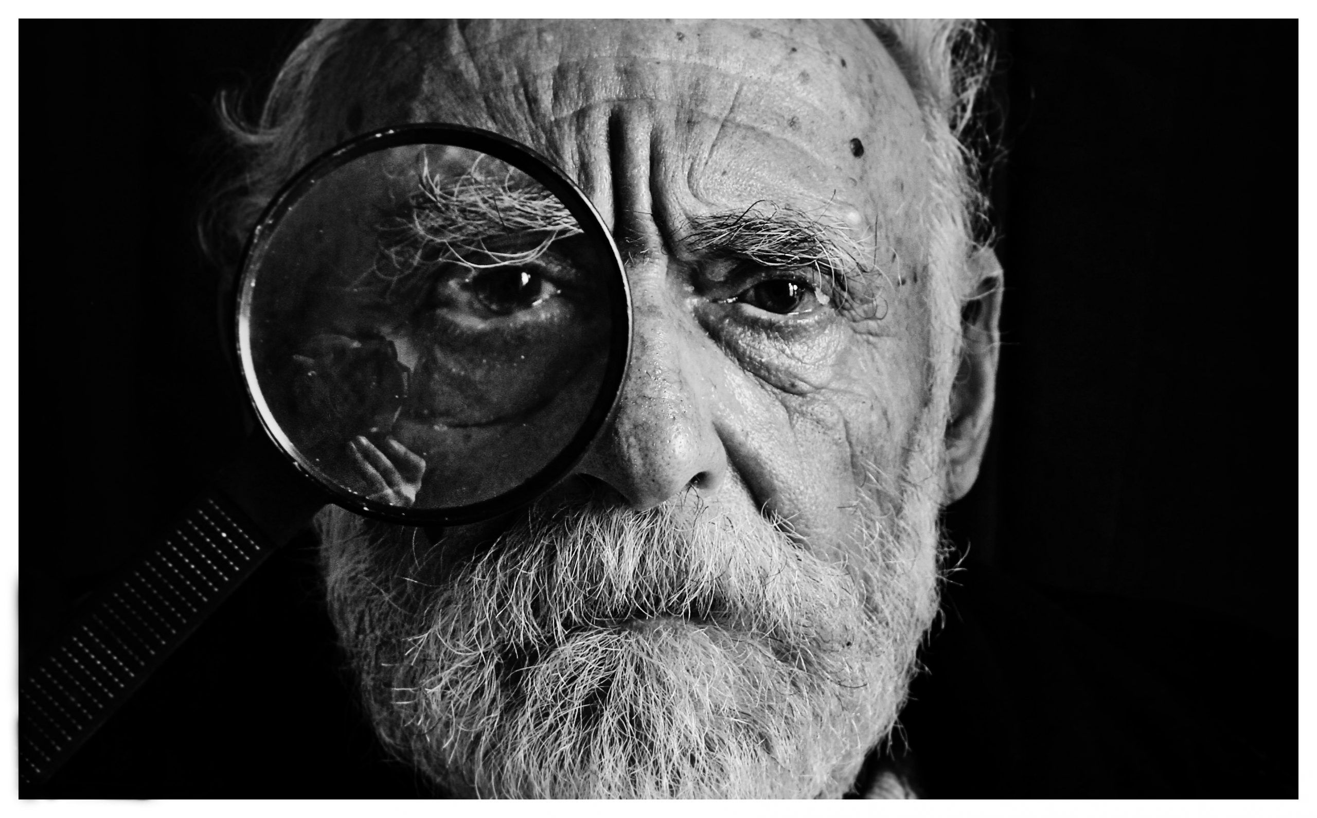 Glaucoma is the second most frequent cause of blindness in the US.