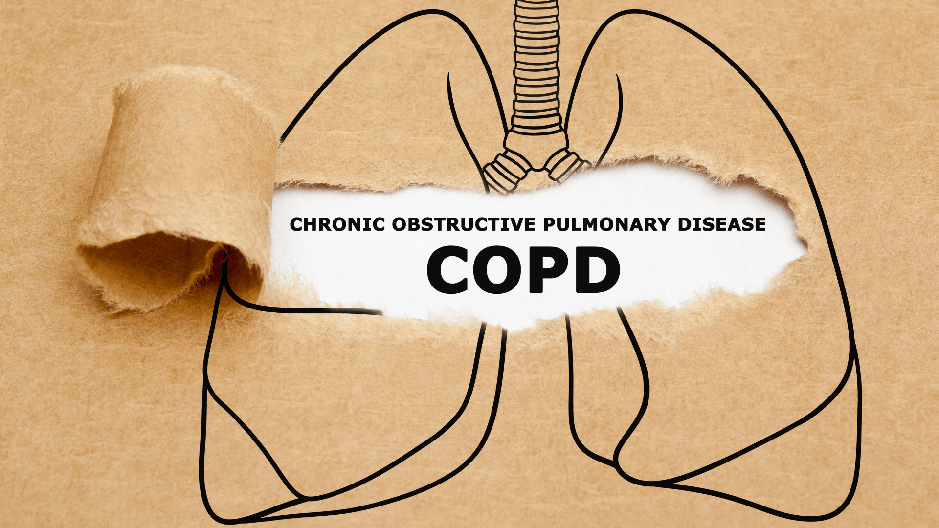 Through a case study, learn how GPs diagnose and treat COPD effectively to improve patient outcomes.