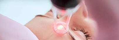 Laser Treatments in Dermatology: An In-Depth Review