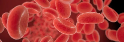 Análisis de las similitudes entre la enfermedad venosa crónica y la diabetes mellitus