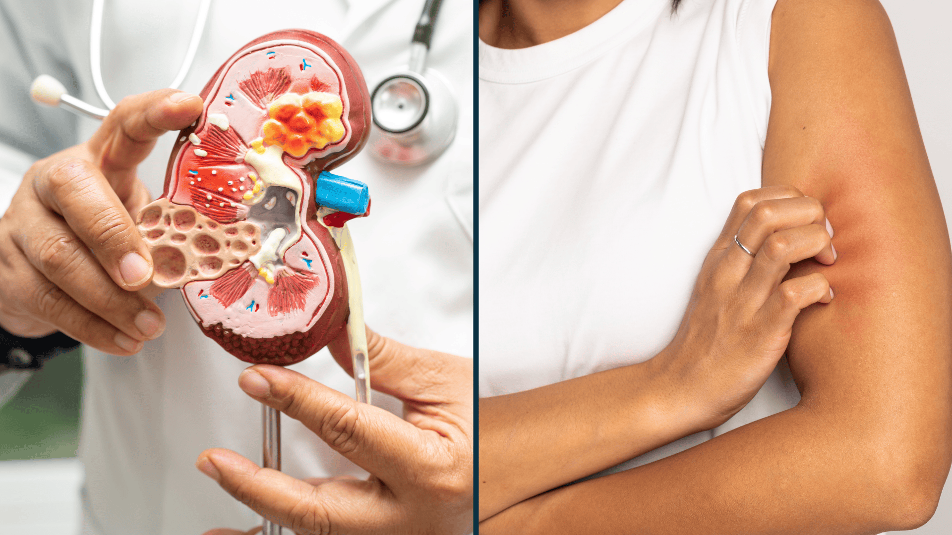 How to address CKD pruritus with innovative strategies to improve patient outcomes.