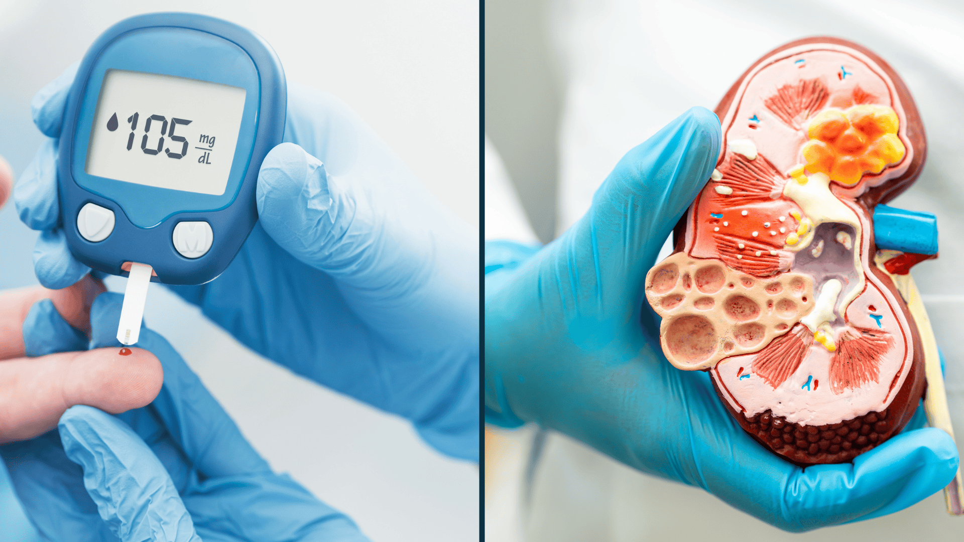 The global health landscape faces a critical challenge: the increasing prevalence of diabetes and chronic kidney disease (CKD).