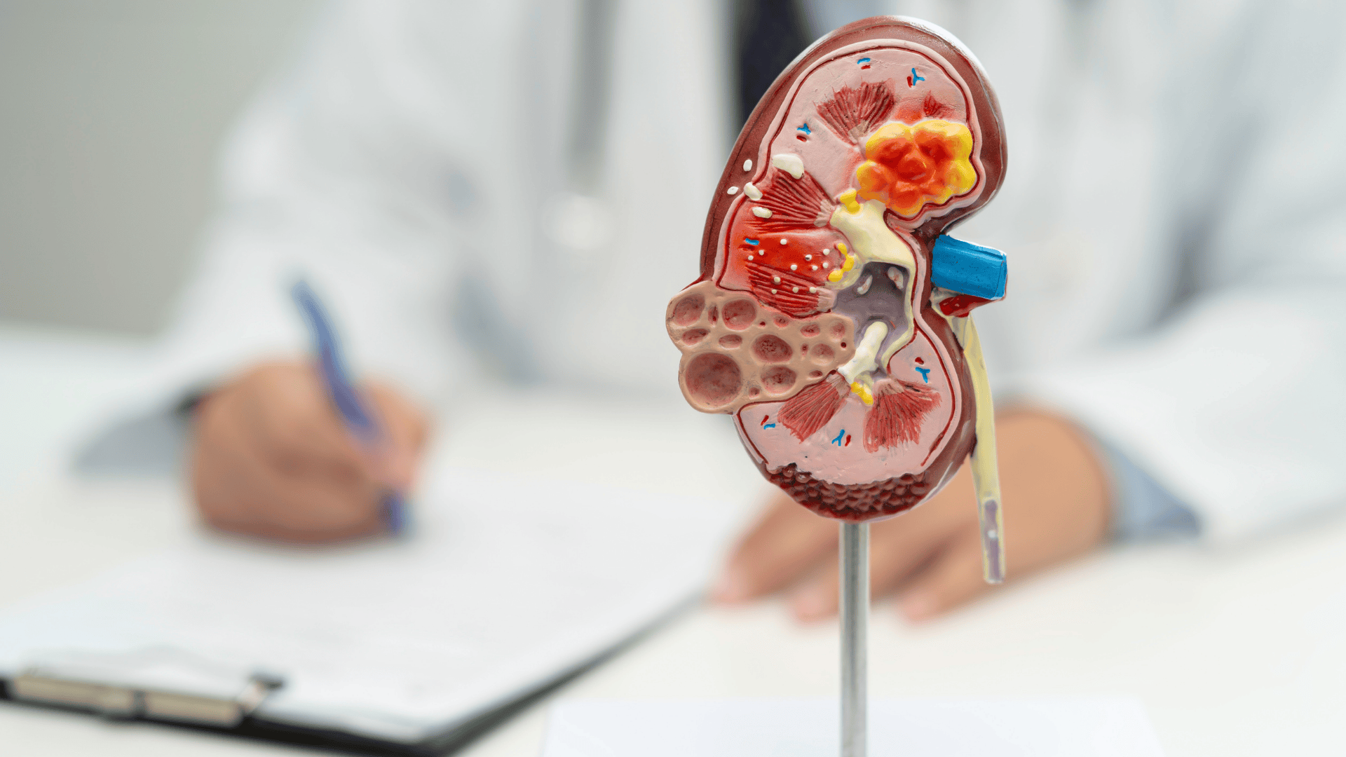 Kidney disease is a silent threat, often undetected until late. Learn how to protect your kidney health with early detection