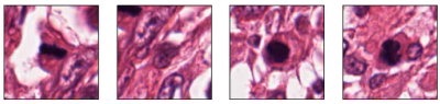 CancerCenterAI