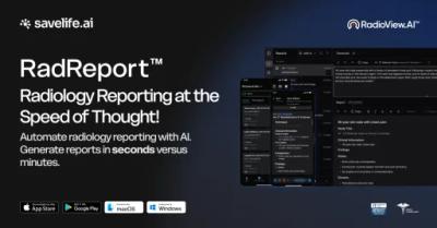 RadioView AI