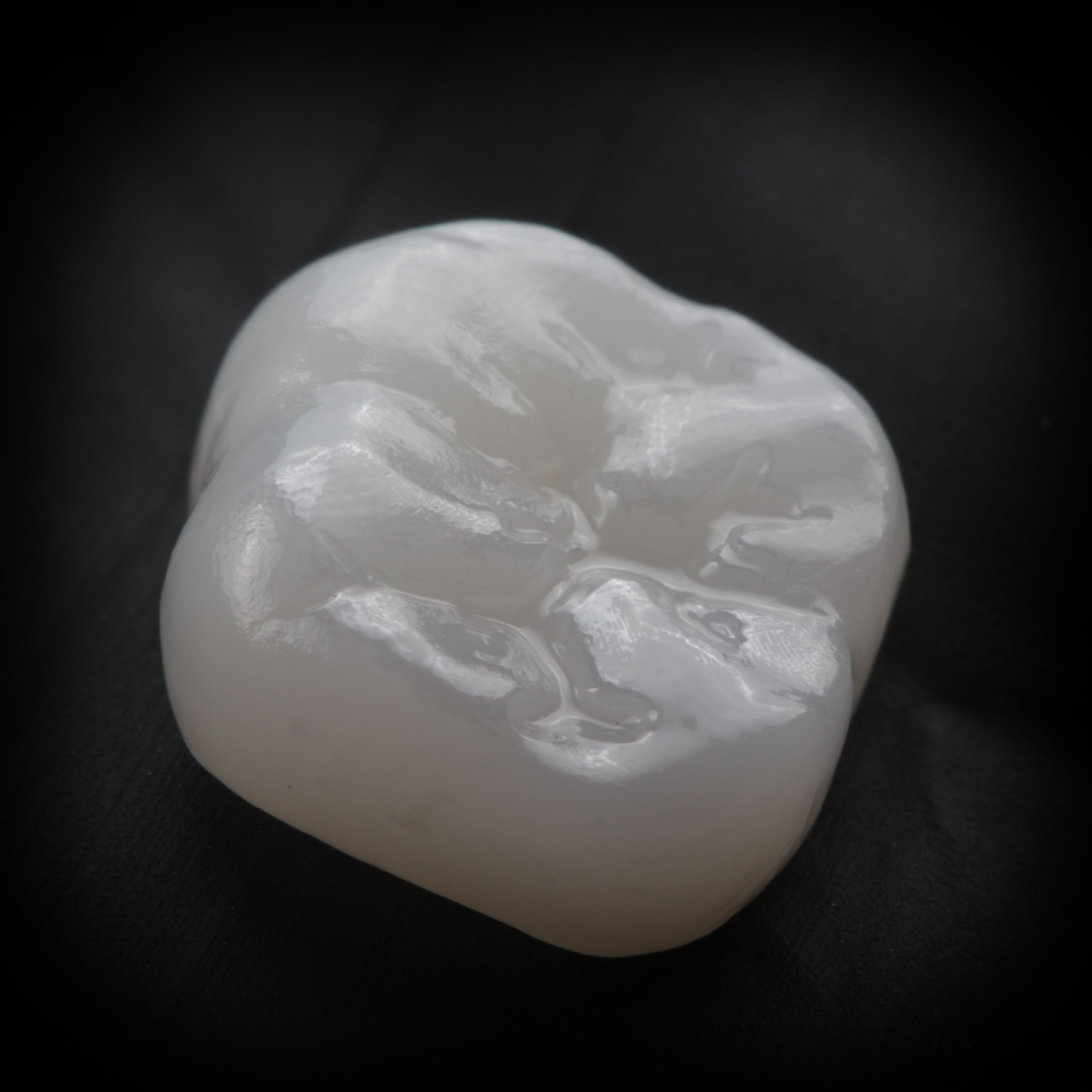 Close-up of a custom porcelain dental crown