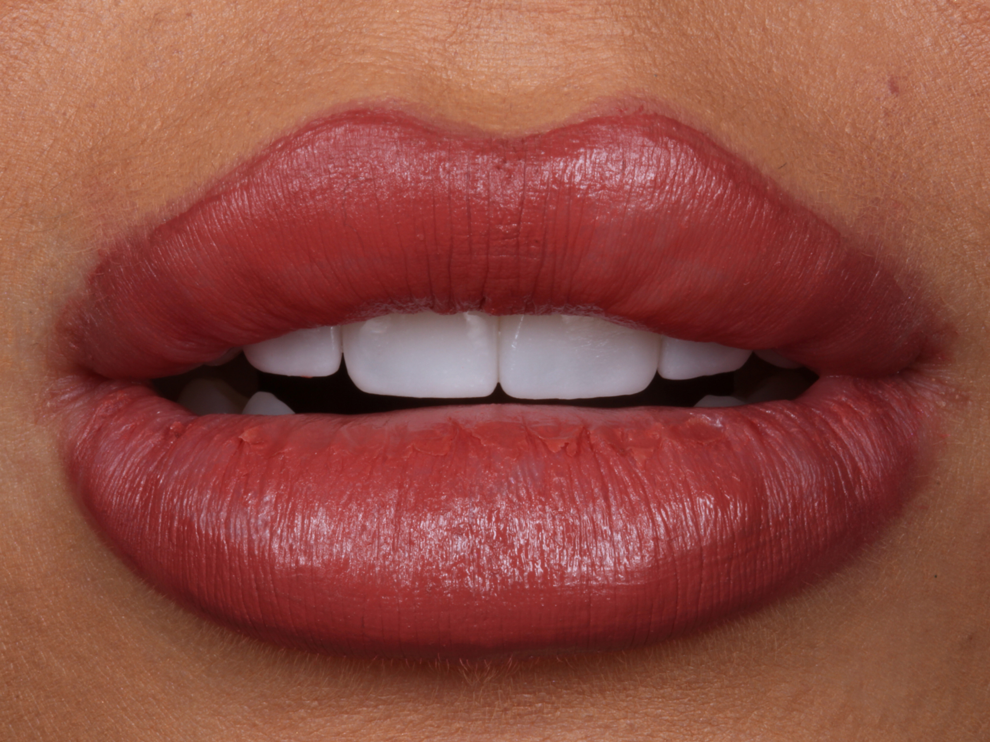 Natural smile showing porcelain veneers result