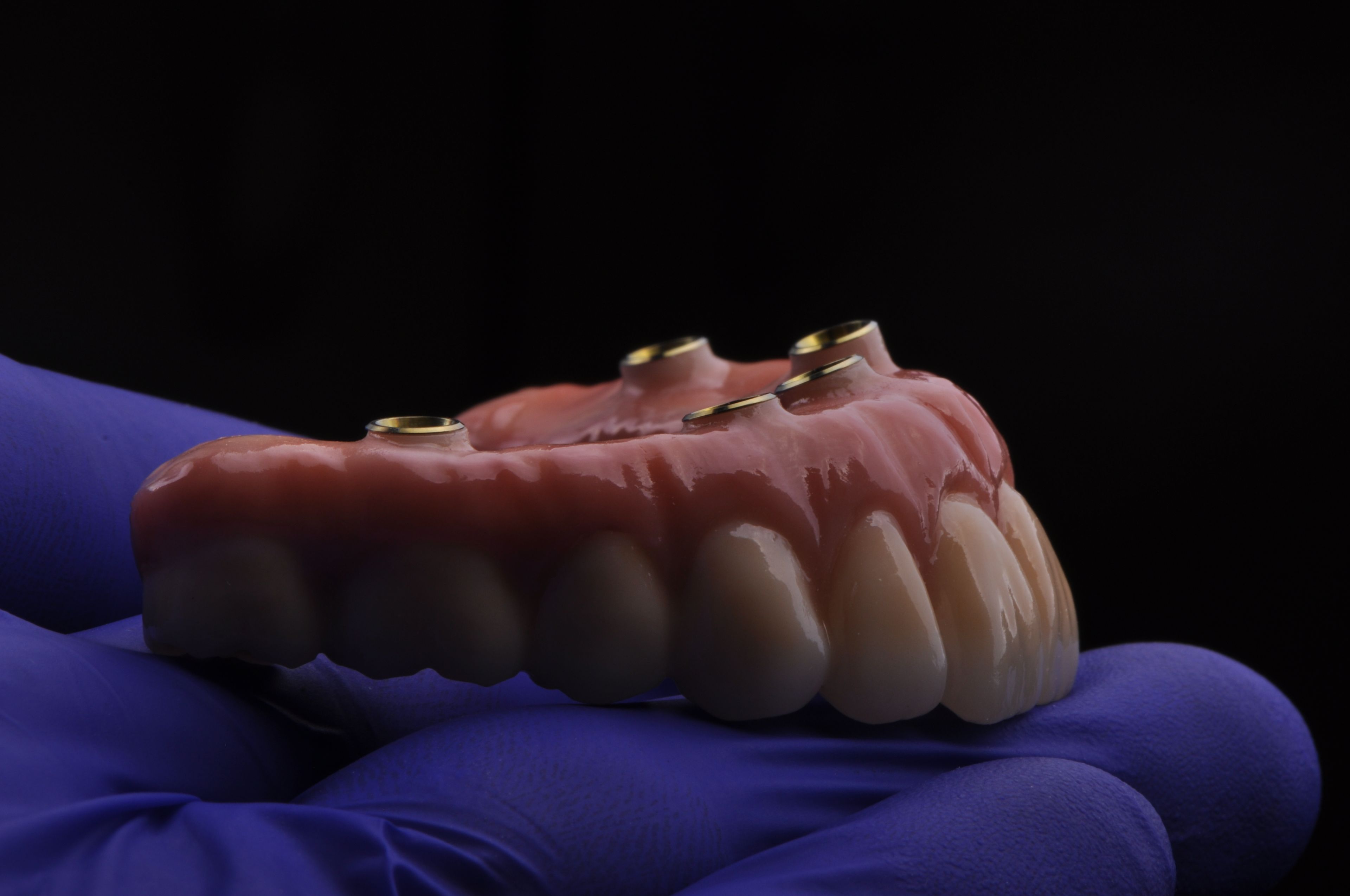 Dental specialist holding a completed full arch implant prosthesis