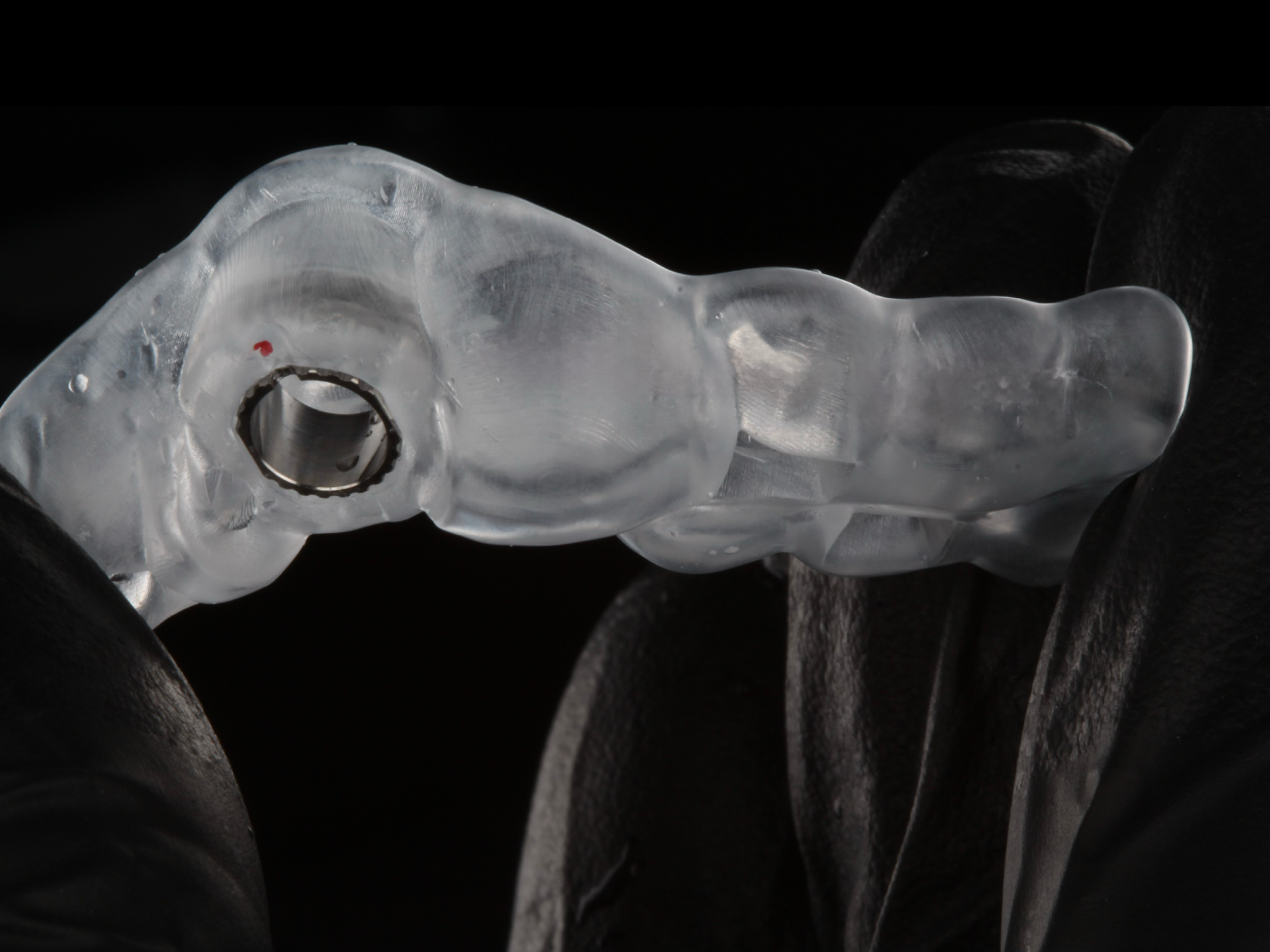 3D-printed surgical guide for precision dental implant placement