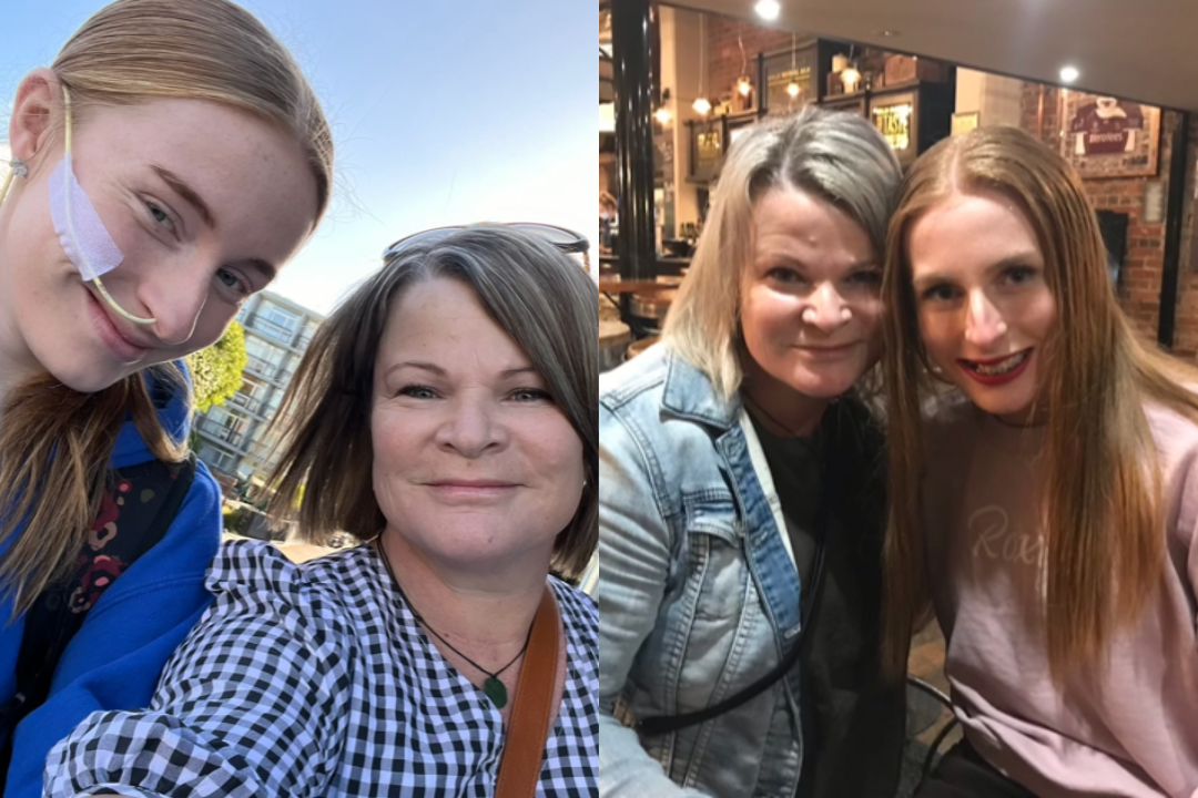 a girl with a tube in her nose and two women posing for a picture a girl with a tube in her nose and two women posing for a picture
