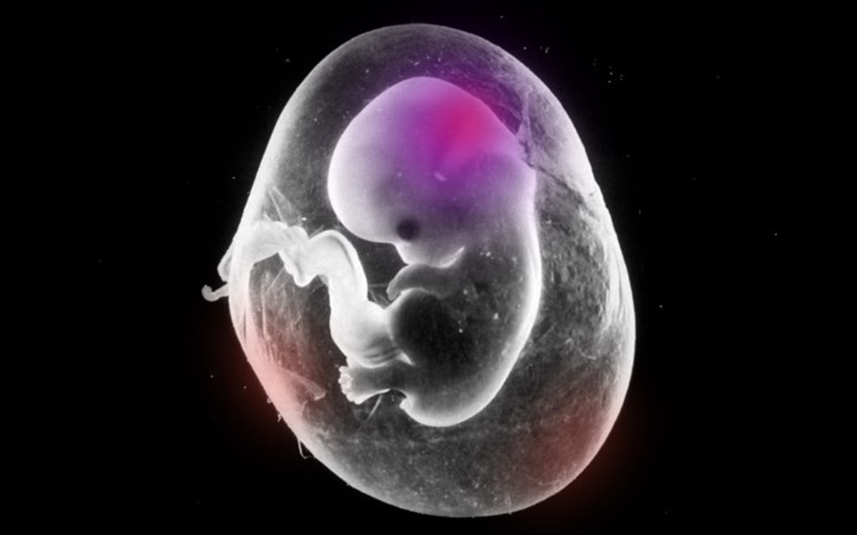 can mother's stress affect fetus health