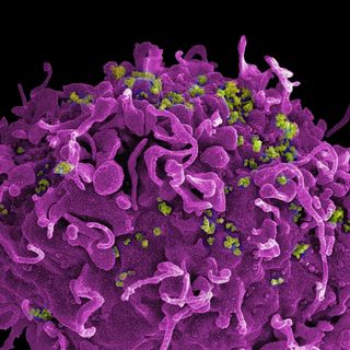 immune system naturally cures HIV