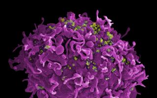 immune system naturally cures HIV