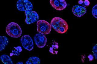 Most women don't know about ovarian cancer