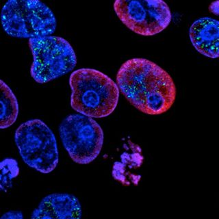 Most women don't know about ovarian cancer