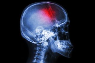 Intimate partner violence injury