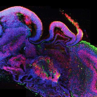 brain organoid ethics