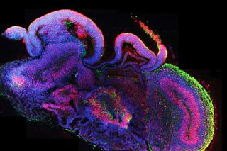 brain organoid ethics