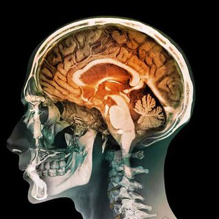 brain traumatic memories