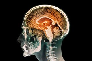 brain traumatic memories