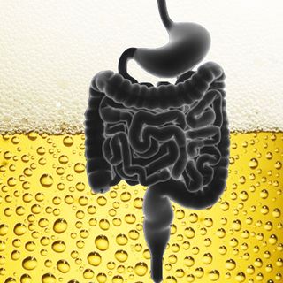 what is autobrewery syndrome