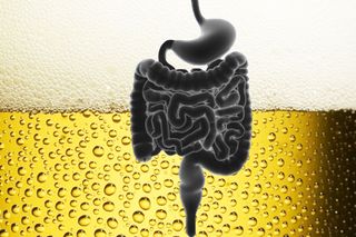 what is autobrewery syndrome