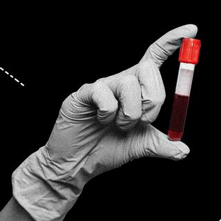 blood test for Alzheimer's