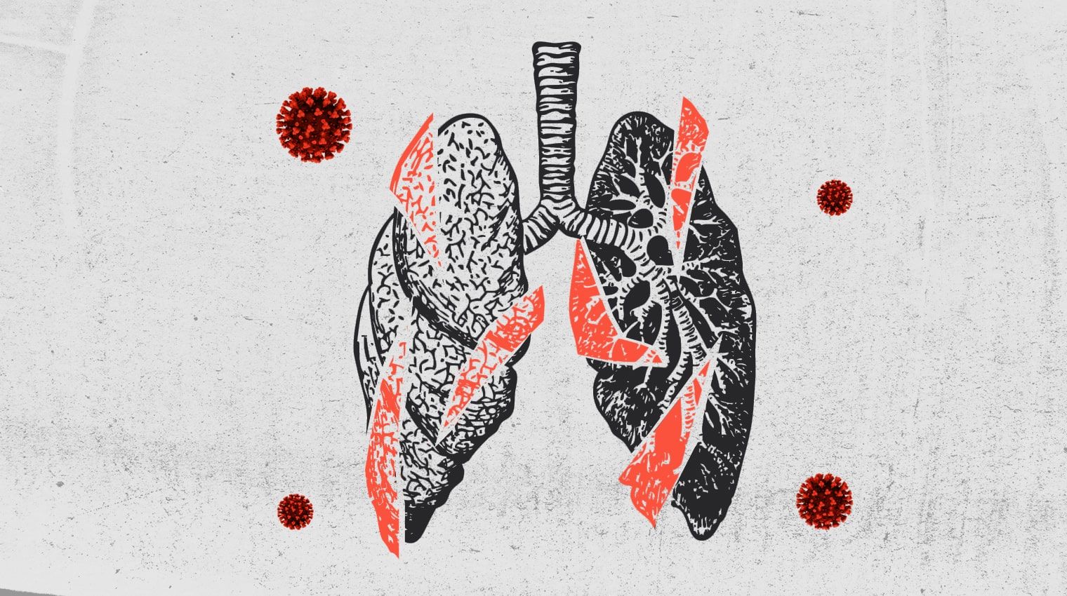 covid19 can cause permanent lung damage