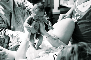intersex at birth