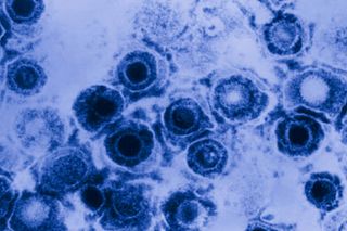 how do you get genital herpes