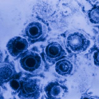 how do you get genital herpes