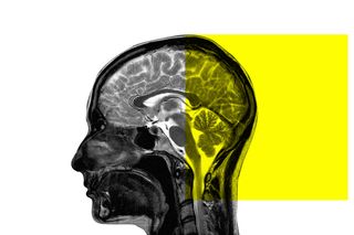 what is cerebral palsy