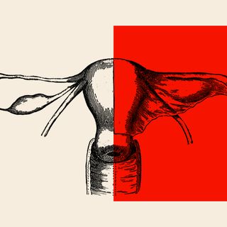 genetic link of endometriosis