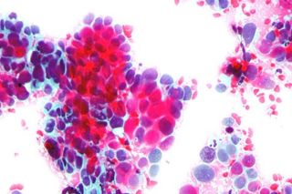 cervical cancer test