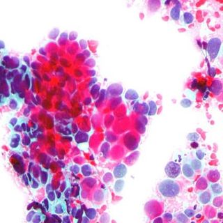 cervical cancer test
