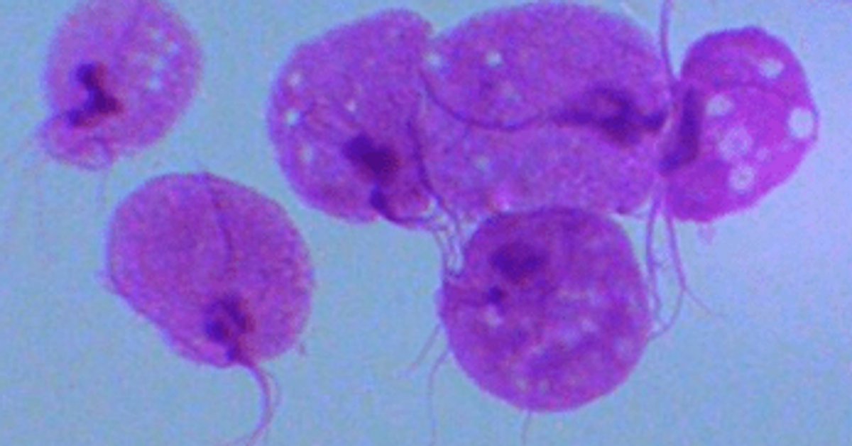 trichomonase masculine