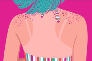 what causes skin cancer