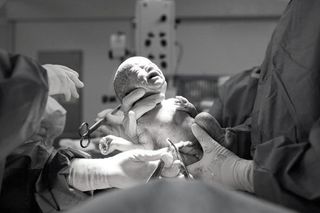 vaginal seeding c-section