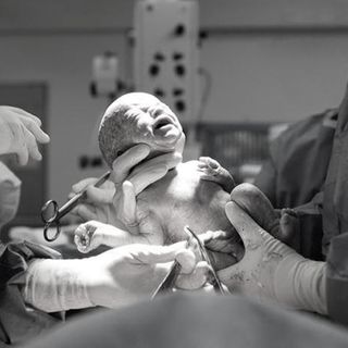 vaginal seeding c-section