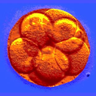 why do ivf embryos fail?