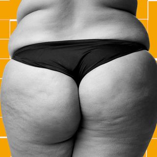 what is cellulite